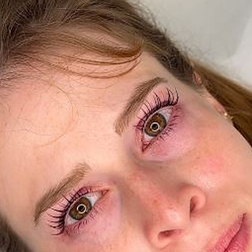 Ergebnis Lashlifting